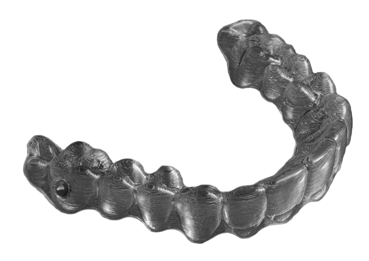 Invisalign Treatment Lower Manhattan